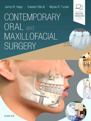 Book Cover Contemporary Oral and Maxillofacial Surgery