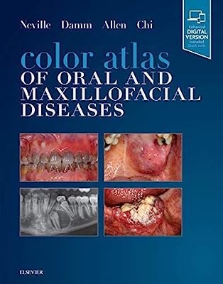 Book Cover Color Atlas of Oral and Maxillofacial Diseases