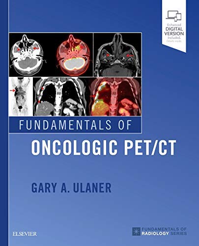 Book Cover Fundamentals of Oncologic PET/CT (Fundamentals of Radiology)