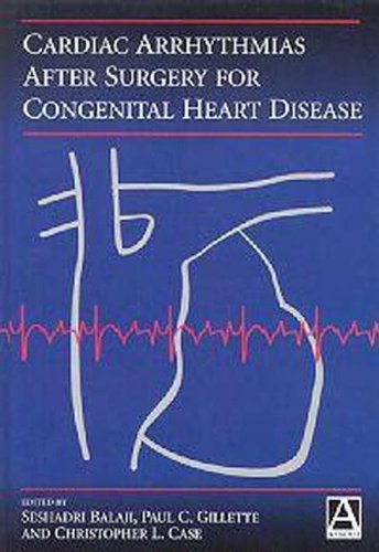 Cardiac Arrhythmias After Surgery for Congenital Heart Disease (Hodder Arnold Publication)
