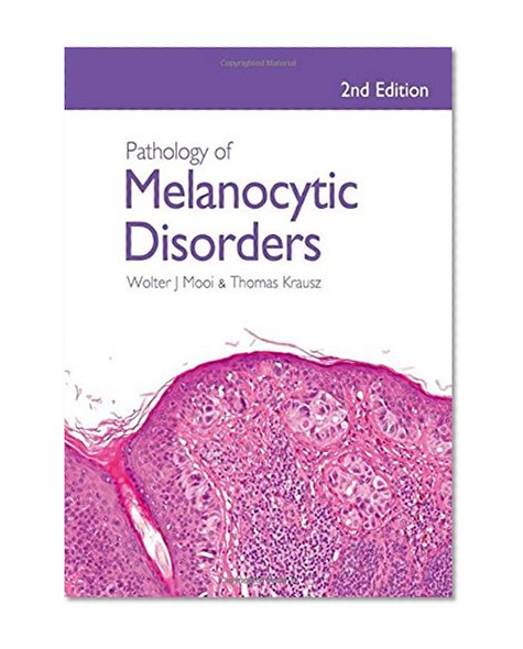 Pathology of Melanocytic Disorders 2ed