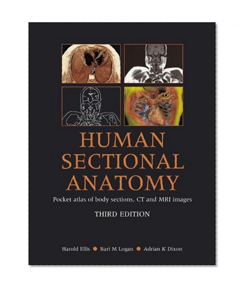 Human Sectional Anatomy: Pocket Atlas of Body Sections, CT and MRI Images, Third Edition