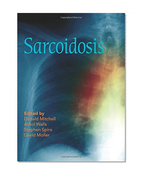 Sarcoidosis