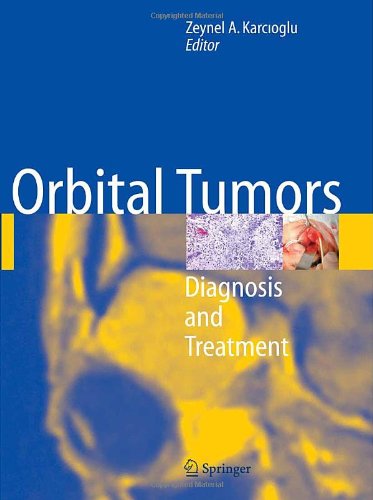 Orbital Tumors: Diagnosis and Treatment