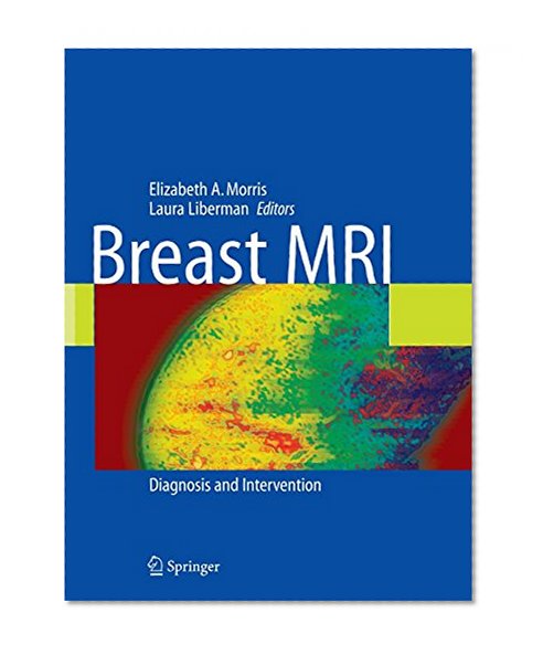 Breast MRI: Diagnosis and Intervention