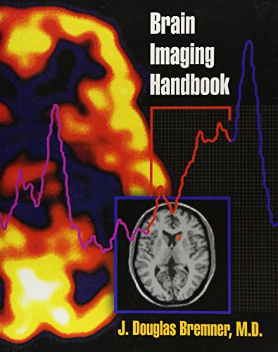 Book Cover Brain Imaging Handbook