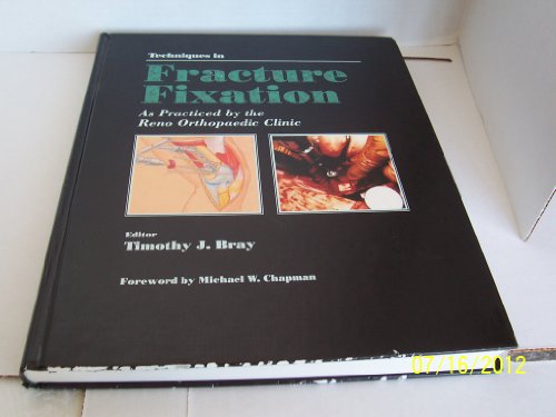 Techniques in Fracture Fixation