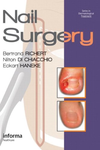 Nail Surgery (Series in Dermatological Treatment)