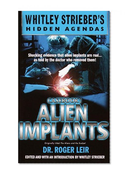 Casebook: Alien Implants (Whitley Strieber's Hidden Agendas)