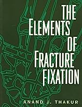 The Elements of Fracture Fixation