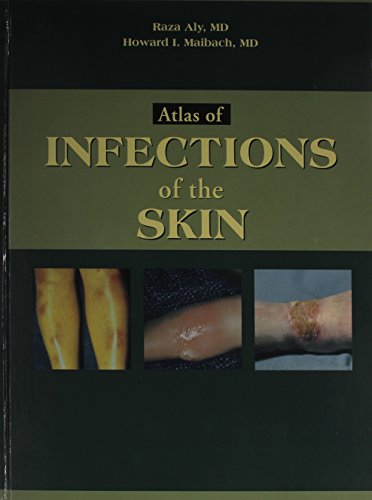 Atlas of Infections of the Skin, 1e