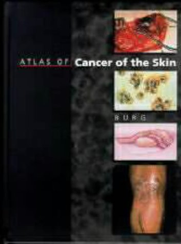 Atlas of Cancer of the Skin (Sams/Lynch colour atlas)