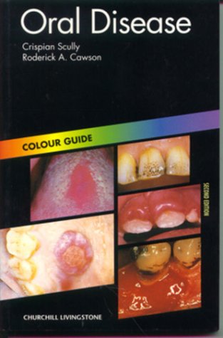 Oral Disease: Colour Guide, 2e (Colour Guides)