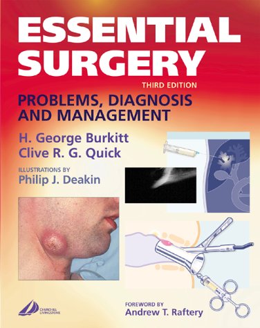 Essential Surgery: Problems, Diagnosis and Management, 3e (MRCS Study Guides)