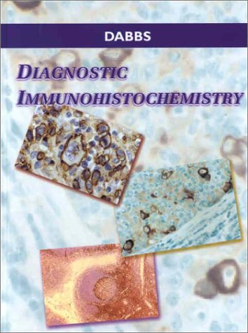 Diagnostic Immunohistochemistry, 1e