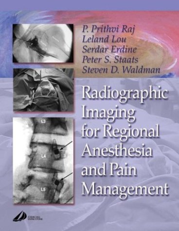 Radiographic Imaging for Regional Anesthesia and Pain Management, 1e