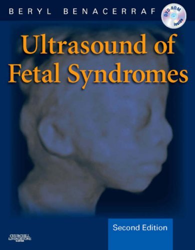 Ultrasound of Fetal Syndromes: Text with DVD, 2e