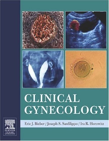 Clinical Gynecology, 1e