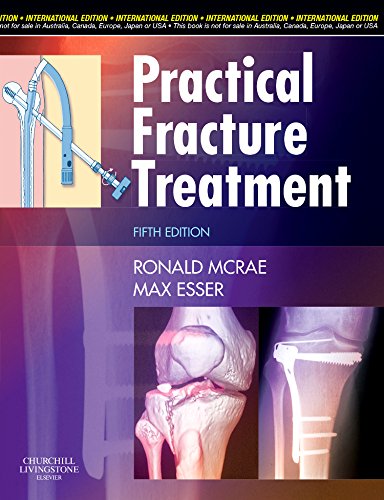 Practical Fracture Treatment
