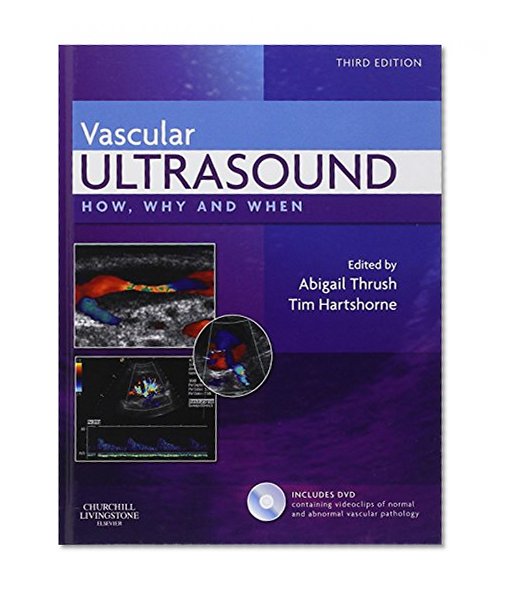 Vascular Ultrasound: How, Why and When, 3e