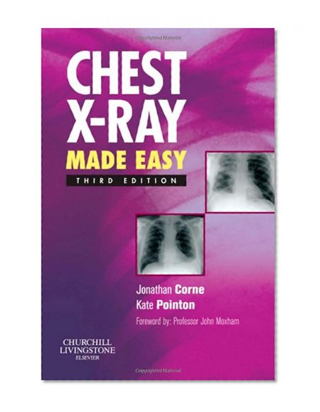 Chest X-Ray Made Easy, 3e