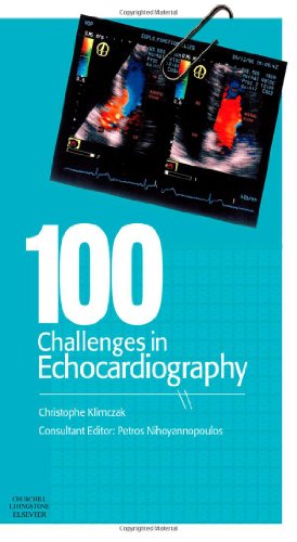 100 Challenges in Echocardiography, 1e