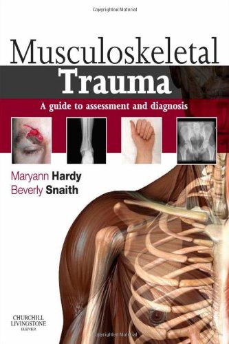 Musculoskeletal Trauma: a guide to assessment and diagnosis, 1e