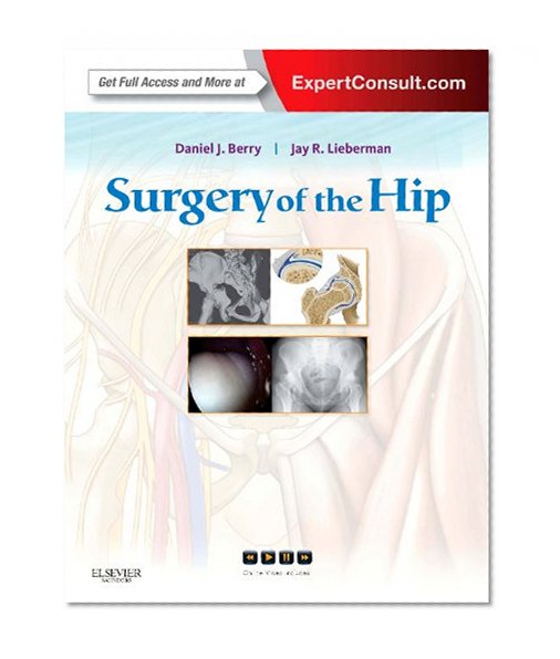 Surgery of the Hip: Expert Consult - Online and Print, 1e