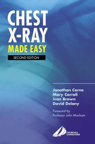 Chest X-Ray Made Easy, 2e