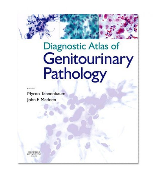 Diagnostic Atlas of Genitourinary Pathology, 1e