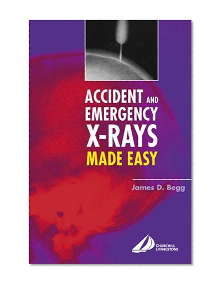 Accident and Emergency X-Rays Made Easy, 1e