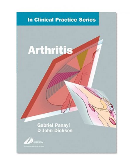 Churchill's In Clinical Practice Series: Arthritis, 1e