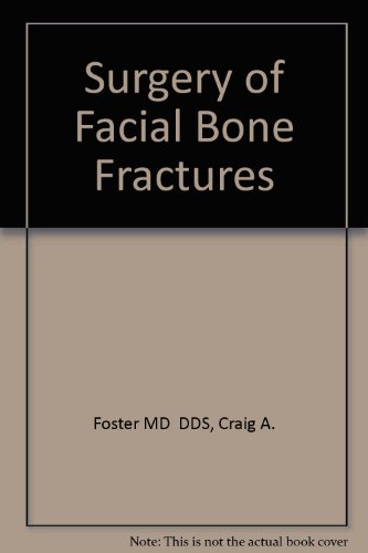 Surgery of Facial Bone Fractures