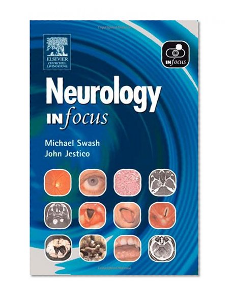 Neurology In Focus, 1e