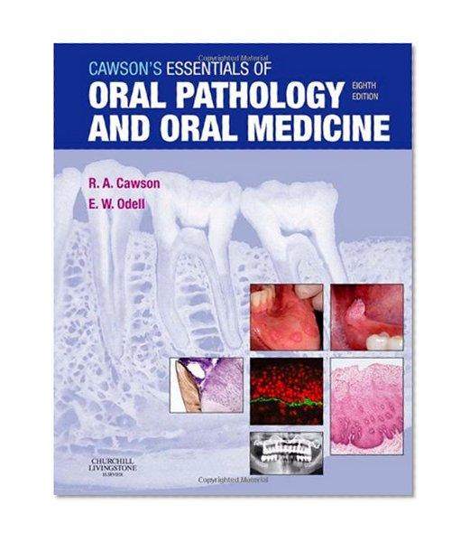 Cawson's Essentials of Oral Pathology and Oral Medicine, 8e