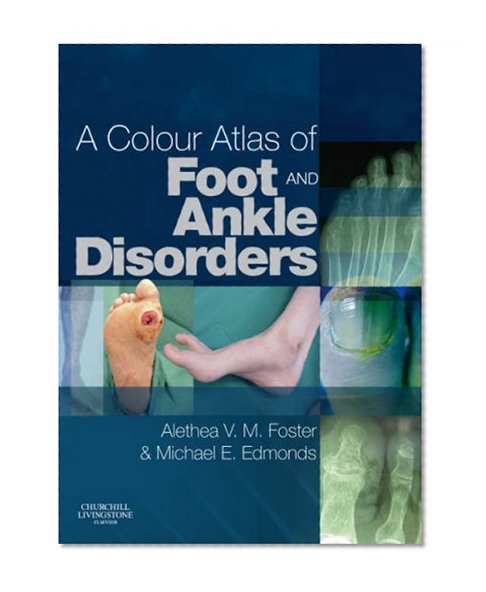 Colour Atlas of Foot and Ankle Disorders