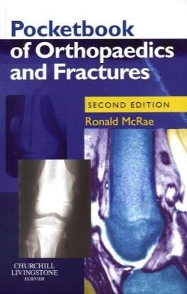 Pocketbook of Orthopaedics and Fractures, 2e (Churchill Pocketbooks)