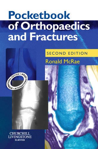 Pocketbook of Orthopaedics and Fractures
