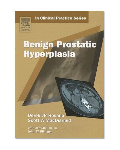 Churchill's In Clinical Practice Series: Benign Prostatic Hyperplasia, 1e