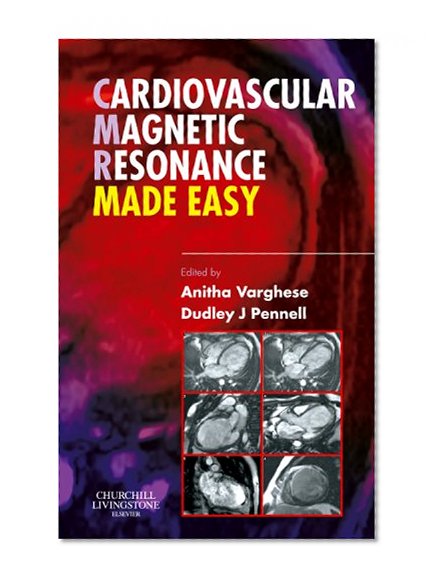 Cardiovascular Magnetic Resonance Made Easy, 1e