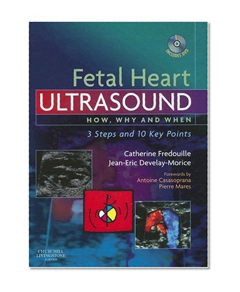 Fetal Heart Ultrasound: How, Why and When, 1e