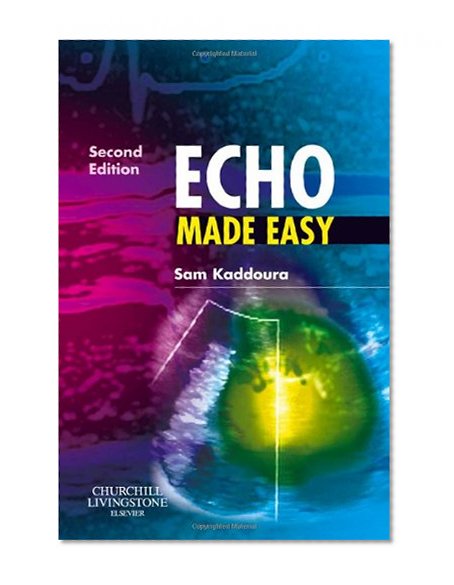 Echo Made Easy, 2e