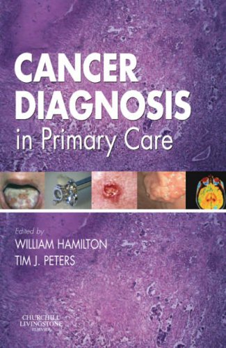 Cancer Diagnosis in Primary Care, 1e