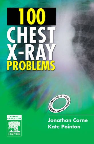 100 Chest X-Ray Problems, International Edition