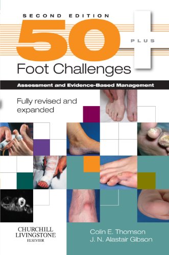 50+ Foot Challenges: Assessment and Evidence-Based Management, 2e