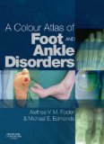 Colour Atlas of Foot and Ankle Disorders