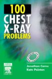 100 Chest X-Ray Problems, International Edition