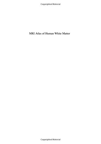MRI Atlas of Human White Matter