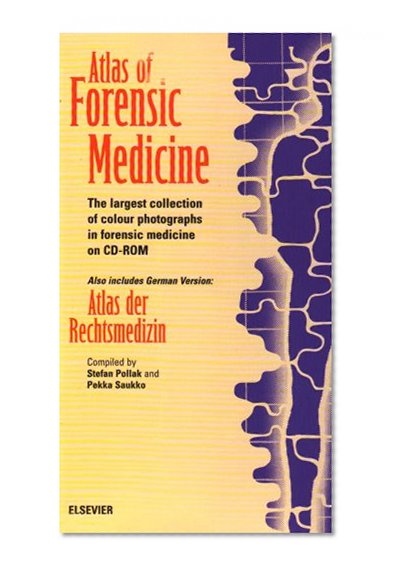 Atlas of Forensic Medicine: CD-ROM, Single User Version, 1e