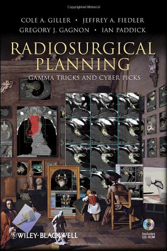 Radiosurgical Planning: Gamma Tricks and Cyber Picks